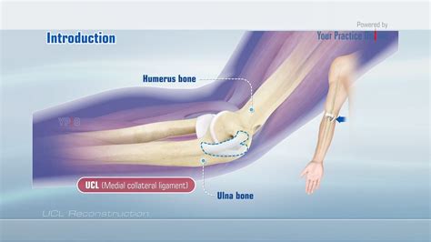 strained ucl recovery time